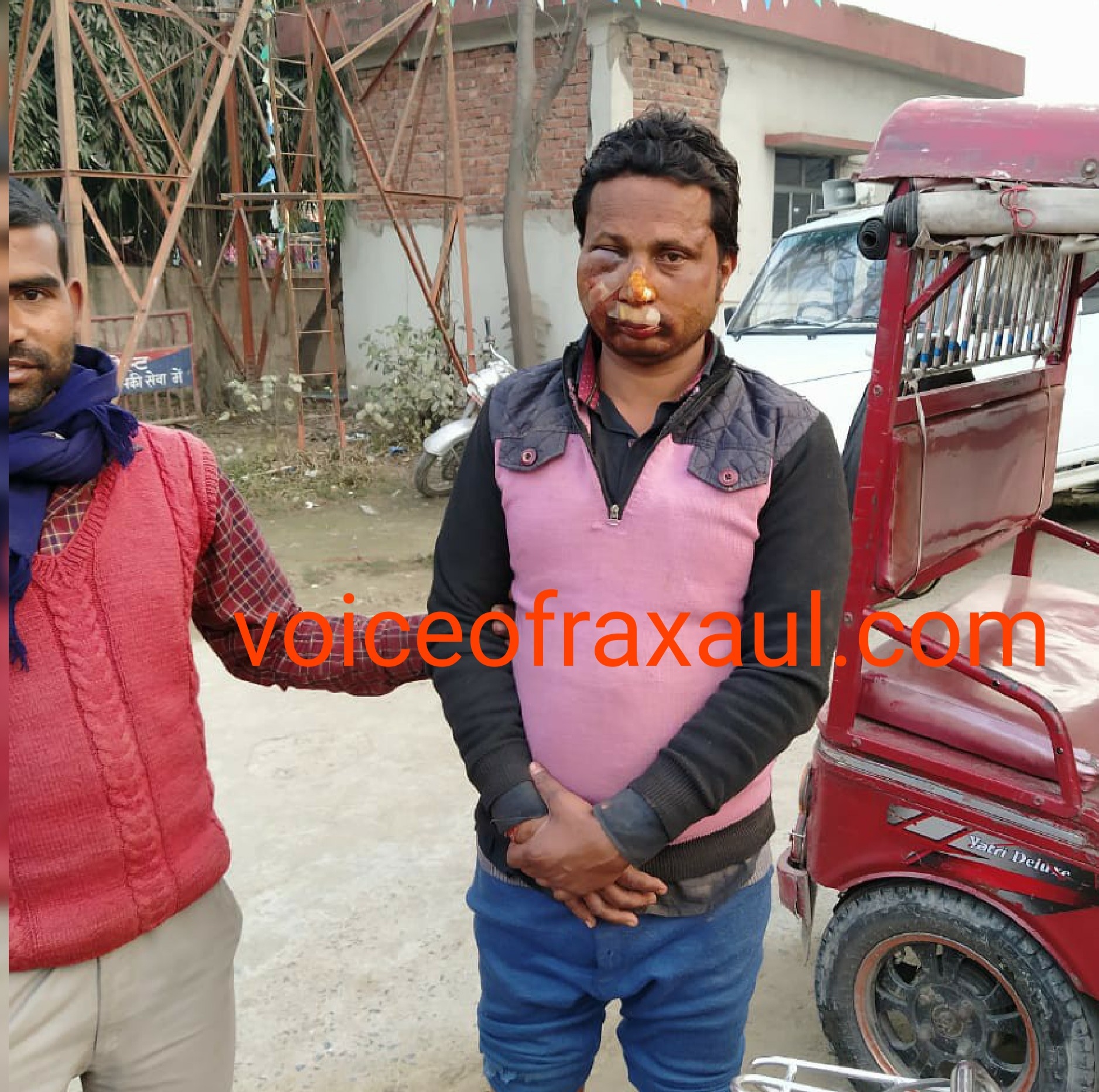 पुलिस की पिटाई से कृषक बुरी तरह जख्मी, रक्सौल पीएचसी में हुआ इलाज!