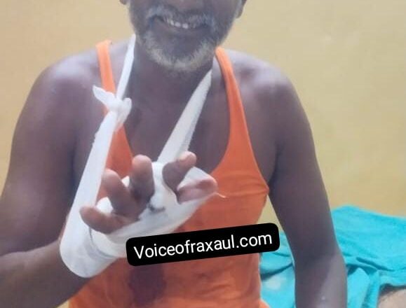 रामगढ़वा में तेंदुए का आतंक: दो गांवों में चार लोगों पर किया हमला, दहशत में ग्रामीण