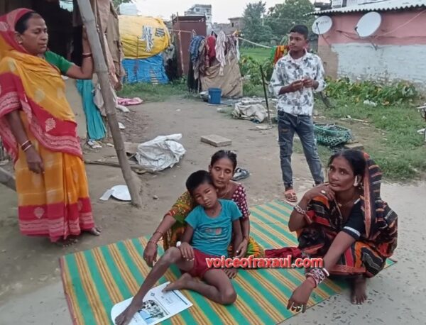 रक्सौल में खेलने के दौरान बच्चों पर हड्डा का उग्र हमला, दो साल के मासूम की मौत से छाया मातम